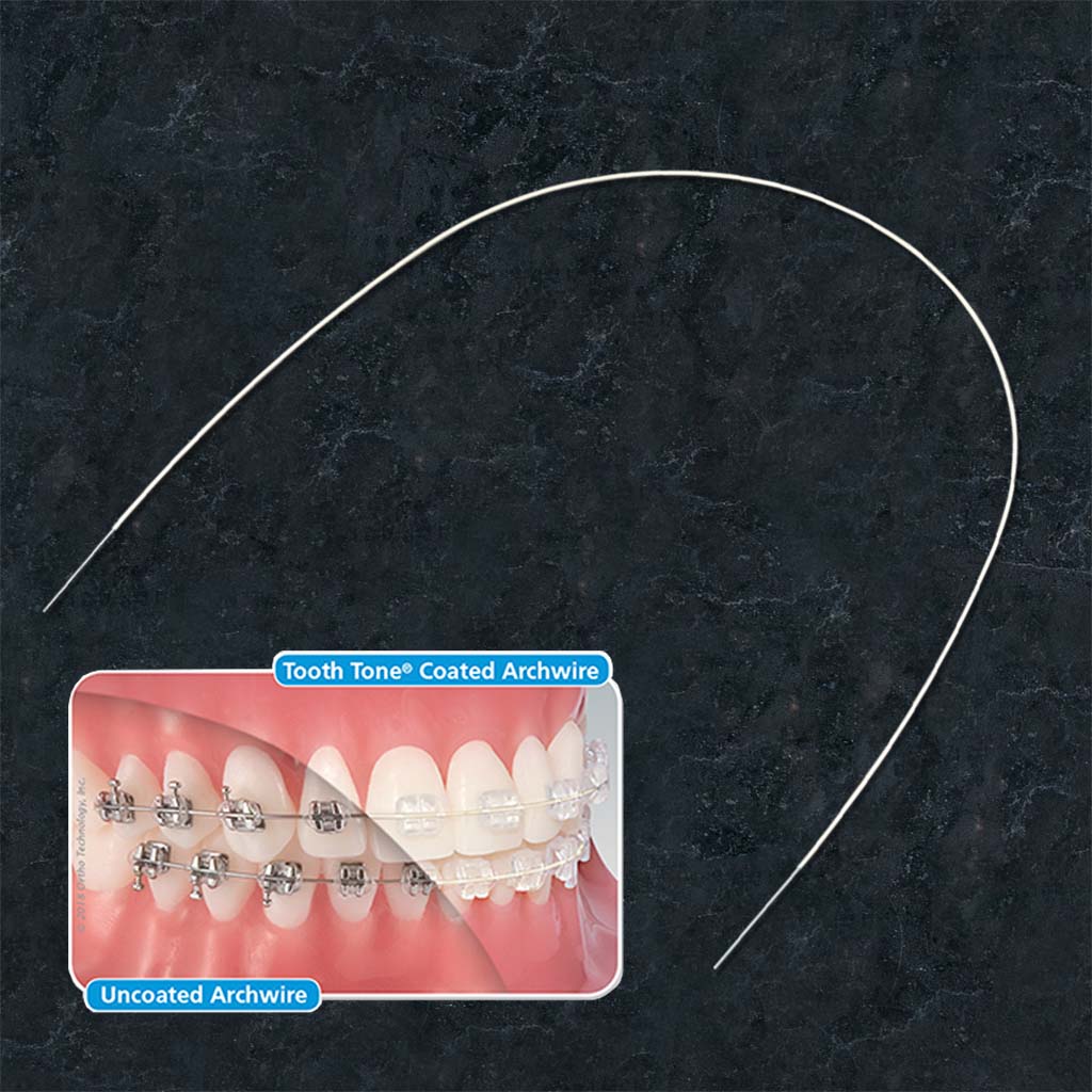 Ortho Technology Tooth Tone Coated NiTi Full Form Archwire, Upper .020&quot;, 10&#39;s/pack